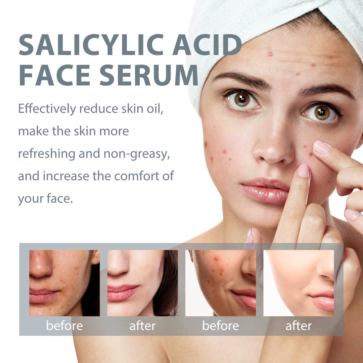 West Month Salicylic Acid Facial Essence, Lighten Acne Mark Repair Hydrating Facial Care Essence
